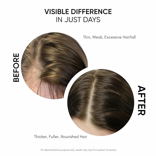Hair Growth Serum with Redensyl & Capixyl for Men & Women