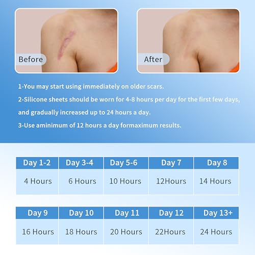 Silicone Scar Sheets (1.6¡± x 120¡± Roll-3M), Scar Tape for Surgical Scars, Reusable, Professional for Keloid Bump Removal, Surgical, C-Section, Tummy Tuck