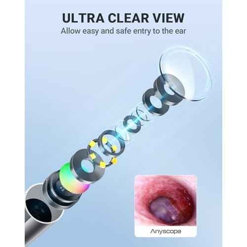 Wireless Otoscope with Gyroscope, Ear Camera with Dual View, 3.9 mm Otoscope with Light, Ear Scope with Ear Wax Removal Tool for Kids, Adults, and Pets, Compatible with iPhone and Android