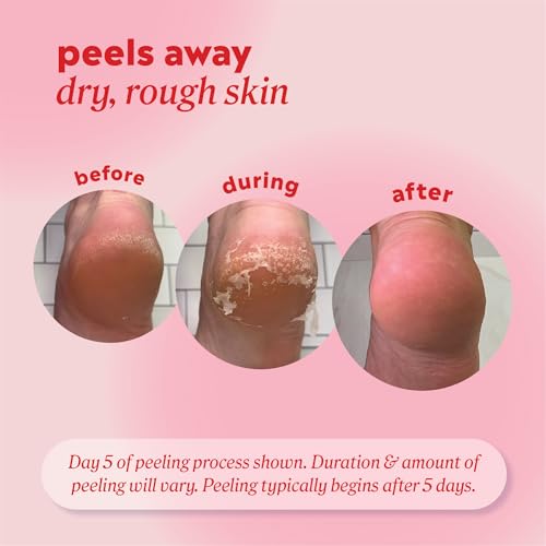 Onyx Professional Exfoliating Foot Peel Mask - Callus Remover (2 Pack)
