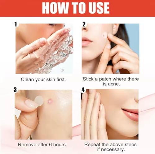 240 Acne Pimple Patches – Hydrocolloid Spot Stickers Waterproof