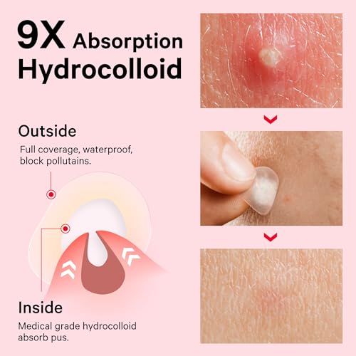Sosky Invisible Hydrocolloid Acne Patches, 120 Count