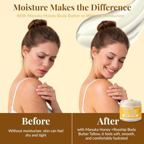 Manuka Honey + Rosehip Tallow 2oz Body Butter - Deeply Nourishing & Repairing Natural Skincare
