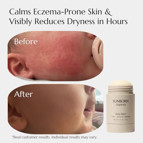 Natural Baby Balm Stick for Eczema & Diaper Rash Relief