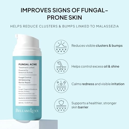 Fungal Acne Treatment Lotion: Helps with Bumps, Clusters, Itch & Redness ? Lightweight Anti-Fungal Face & Body Moisturizer for Fungal Skin with Natural Actives & Soothing Plant Extracts