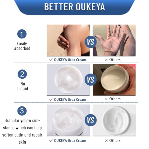 OUKEYA 40% Urea Foot & Hand Cream 5.29oz (1P) - Dry Cracked Skin Repair