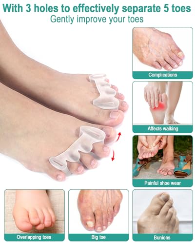 Golbylicc Gel Toe Spacers - 2 Pairs Bunion Corrector