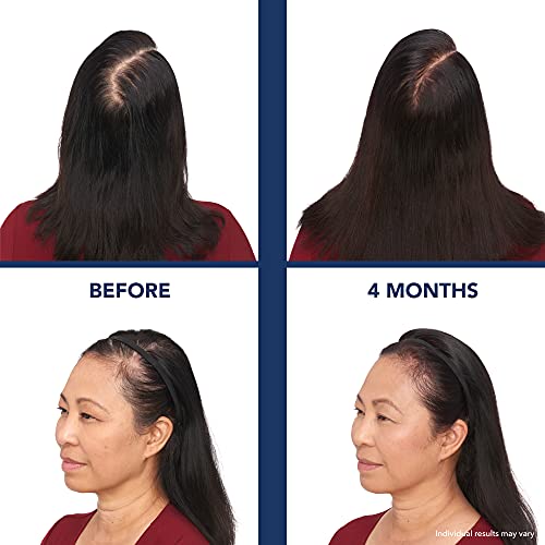 Bosley Revitalizer 164 Flex 100% Laser No LEDs Hair Growth Cap (LLLT) Men and Women - Regrowth, Home Treatment, Thicker, Fuller, Healthy Hair, FDA Cleared, Large/X-Large Size