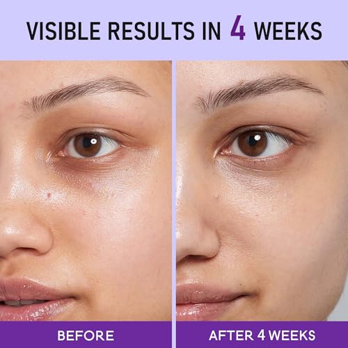 Caffeine Eye Cream for Dark Circles - 5% Caffeine Eye Serum Infused with Collagen and Niacinamide, Cream for Puffines and Bags Under Eyes w/ 360¡Æ Depuffer Roller