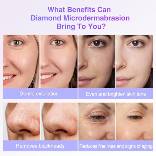 UNOISETION Diamond Dermabrasion Head, 6 PCS Dermabrasion Replacement Tips, Professional Microdermabrasion Accessories for Microdermabrasion Machine
