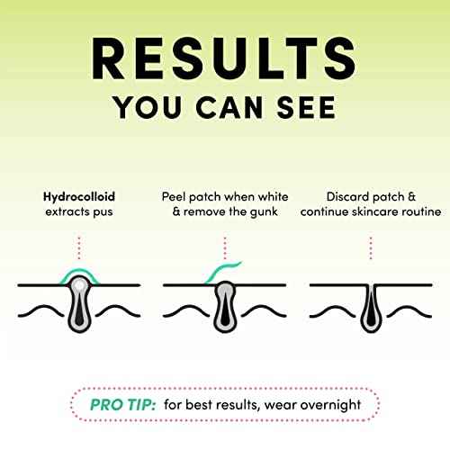 Dots for Spots Pimple Patches For Face - Fast Acting, Translucent Hydrocolloid Zit Patches that Unclog Pores - Korean Skincare - Vegan, Cruelty Free - (120 count)