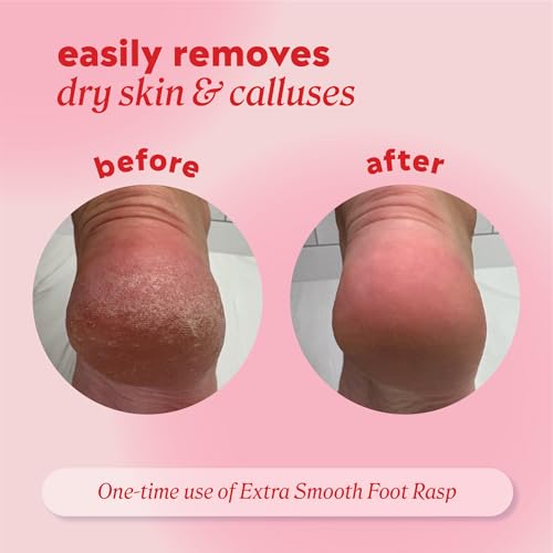 Onyx Professional Stainless Steel Foot Rasp & Callus Remover with Debris Catcher