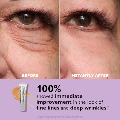 Peter Thomas Roth Instant FIRMx Eye Tightener | Under-Eye Bags