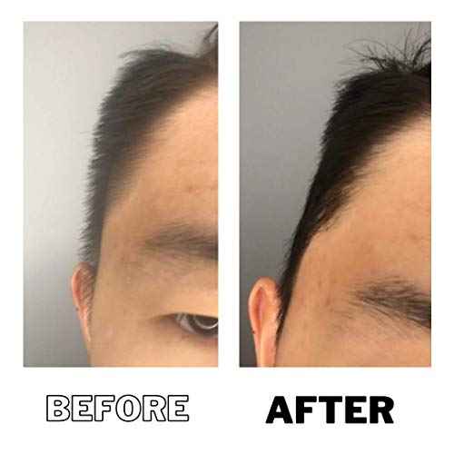 Down Perm | DPERM Serum Concentrate Kit