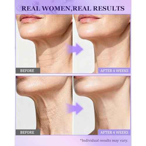 Neck Firming Cream for Tightening | Anti-Aging Face Moisturizer for Women | 1% Retinol + 7% Hyaluronic Acid for Firming & Wrinkle Reduction | Day & Night Use for Neck & D?collet?, 1.7 Fl Oz