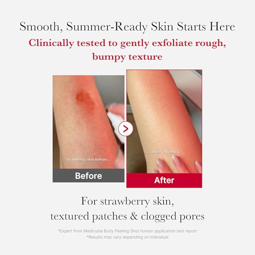 Medicube Red Body Peeling Shot - AHA BHA Exfoliating Spray 3.88oz