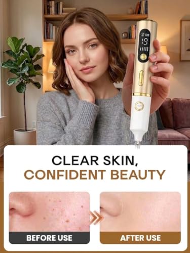 Skin Tag Remover Pen - 19 Intensity Levels & LED Light