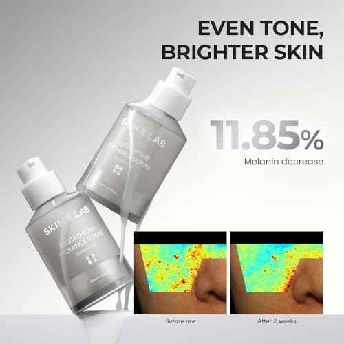 [SKIN&LAB] Gluthathione Radiance Serum with Niacinamide and Alpha-Bisabolol, Even Skin Tone, Brighten Dark Spot and Hyperpigmentation?, Korean Skincare for Uneven Tone, 1.01 Fl. Oz
