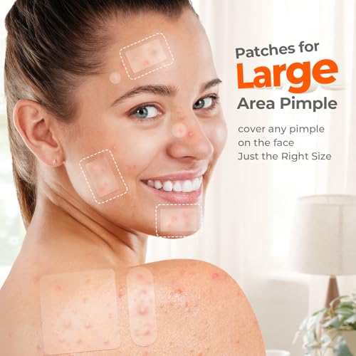 Large Pimple Patches for Face, 7 Sizes Big Acne Patches, FSA Eligible XL Hydrocolloid Bandages for Body, Chin, Forehead, Nose, Blemish Zit Breakouts, Hydrocolloid Patch (Square, Strip, Dot 142 Count)