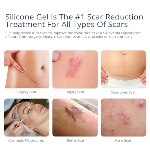 100% Silicone Scar Gel 2 Pack: 2 x 1.06oz Tubes for Surgical Scars, C-Section, Acne, Keloids, Burns, Stretch Marks ? Advanced Scar Treatment for Old & New Scars