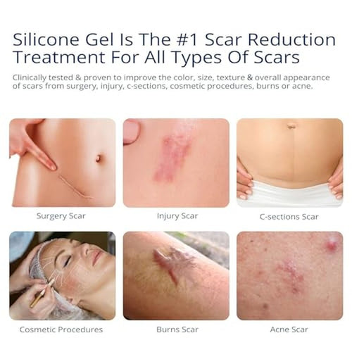 100% Silicone Scar Gel 2 Pack: 2 x 1.06oz Tubes for Surgical Scars, C-Section, Acne, Keloids, Burns, Stretch Marks ? Advanced Scar Treatment for Old & New Scars