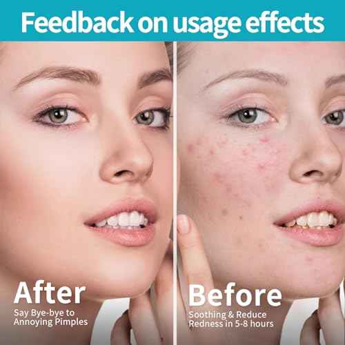 Pimple Patches for Face (1296 Count),3 shapes (Round,Star and heart Shapes),Hydrocolloid Spot Dots with Salicylic Acid and Tea Tree Oil