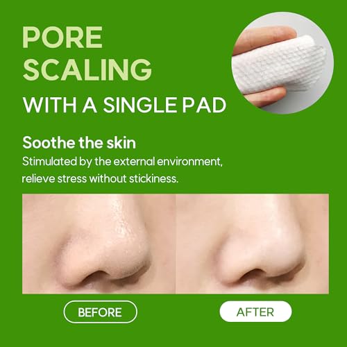 FRUDIA Pore Peeling Pad ? 70 Pads, 5.7?fl?oz | Vegan Exfoliating Toner Pads with 89% Green Grape Extract, Tannin Complex & Anti?Sebum P | Gentle, pH?Balanced Deep Pore Care for Sensitive Oily Skin