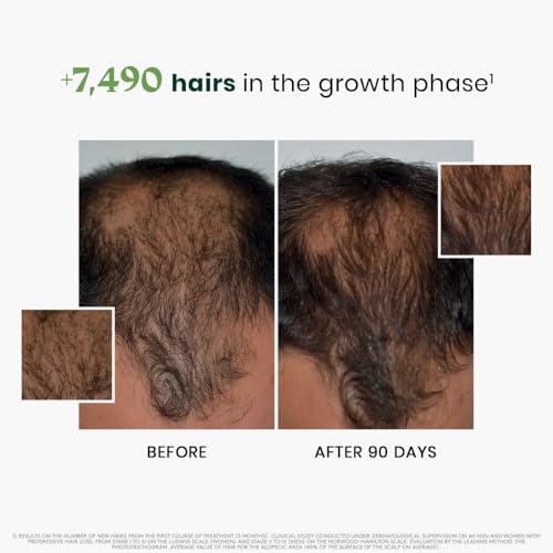 René Furterer Triphasic Concentrated Serum for Thinning Hair