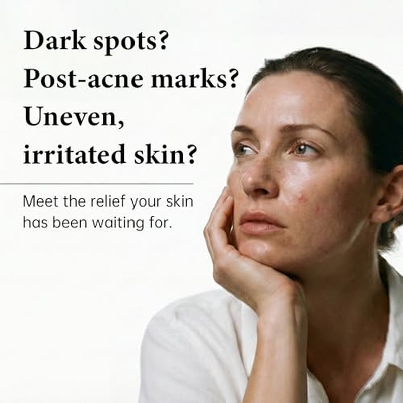 Barrier Cream with Niacinamide, Arbutin & Tranexamic Acid, Korean Skin Care Moisturizer for Soothing Repairing & Blemish Care, Vegan & Gentle Formula for All Skin Types, 1.69 Fl Oz