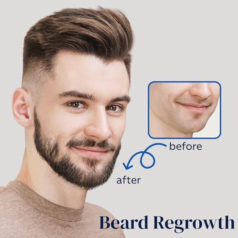 5% Minoxidil Hair Growth Spray for Men & Women, 180ml