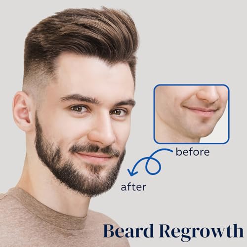 5% Minoxidil Hair Growth Spray for Men & Women, 60ml (2-Pack)