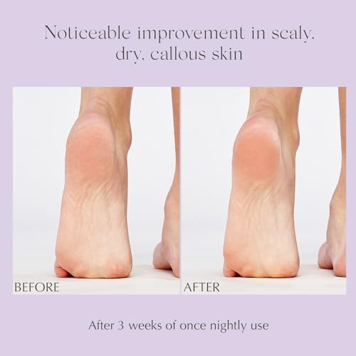 EXUVIANCE Exfoliating & Conditioning Foot Balm - 20% AHA/PHA, 1.7 oz