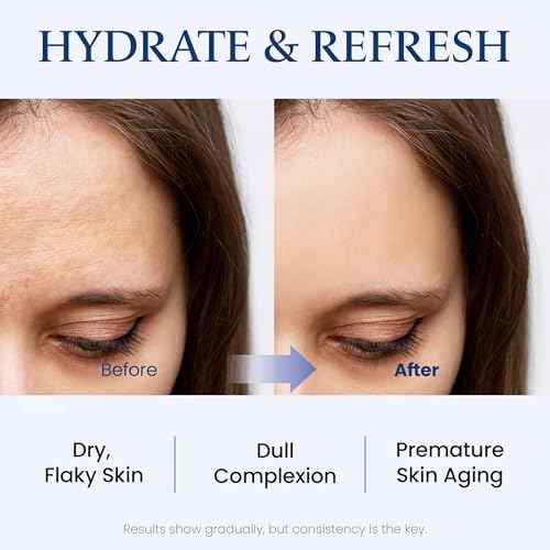 MAXCLINIC Water Lift Moisture Ampoule for Dry Skin | Deeply Hydrating Serum for Face | Fortifying Facial Serum & Ampoule Korean Skin Care | Highly Moisturizing Face Serum (3.38 fl oz)