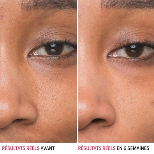 IT Cosmetics Bye Bye Pores 10% Glycolic Acid Face Serum - Visibly Minimizes Pores In 1 Week & Gently Exfoliates to Help Refine Skin¡¯s Texture - With Hyaluronic Acid for Hydration -1 Fl. Oz