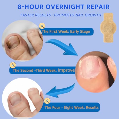 Nail Care Patches - 21 PCS Overnight Toenail Repair for Healthy Nails