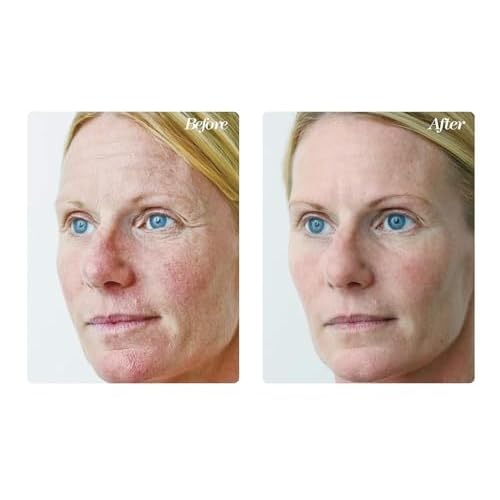 Osmotics Blue Copper 5 Firming Elasticity Repair ? Cream for Firmness and Acne. Visible Results, Made in the USA