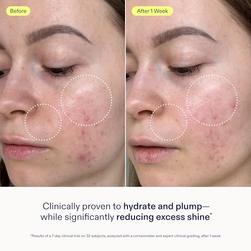 Skinfix Skin Barrier Restoring Gel Cream - 1.7 oz - Non-Greasy Moisturizer for Normal to Combination Skin - Hydrates, Plumps & Smooths - Non-Comedogenic, Fragrance Free, Vegan, Cruelty Free