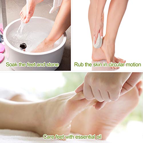 2PCS Natural Pumice Stone Foot & Hand Callus Remover - Lava Pedicure Tool Set