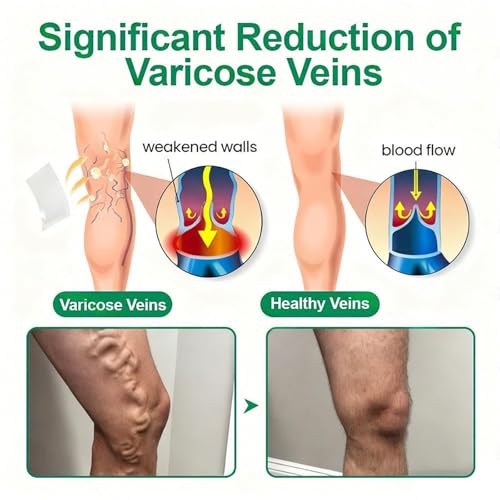 Varicose Veins Patch for Legs - Relief & Skin Smoothing (4 Pack)