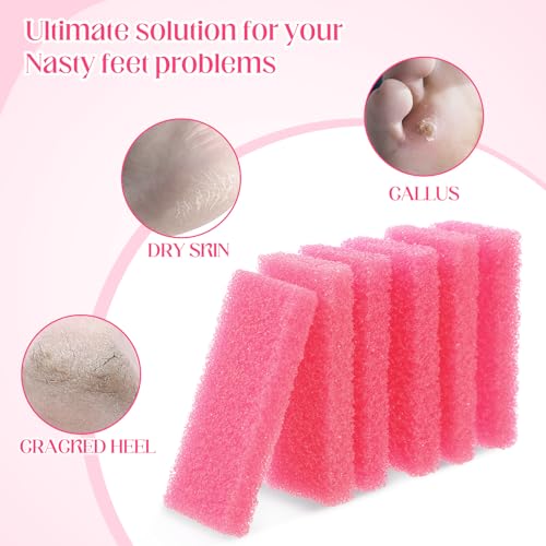 Batiyeer Disposable Pumice Stones for Feet - 100 Pack Foot Callus Remover (Pink)