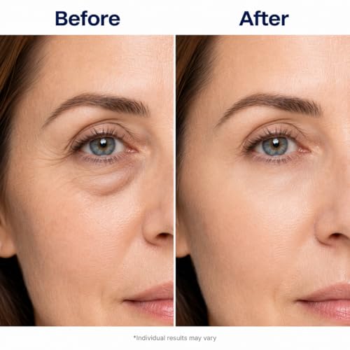 Retinol Collagen Eye Patches - 30 Pairs Under Eye Masks