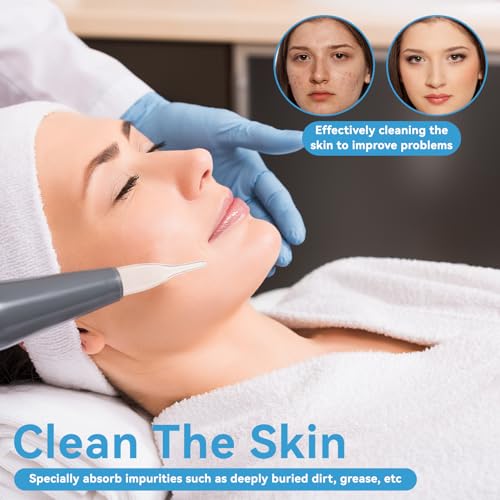 3pcs Vacuum Glass Tube Kit, Blackhead Removal Facial Suction Pore Vacuum Cleaner for Face Cleanser Blackhead Removal Machine Microdermabrasion Machine Accessories