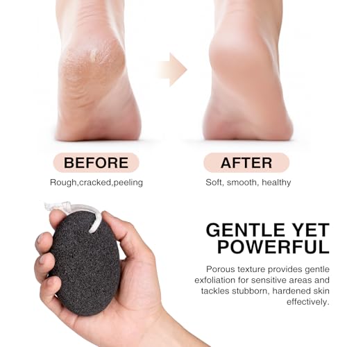Natural Volcanic Lava Pumice Stone Set - 3-Pack Foot Scrubber for Calluses