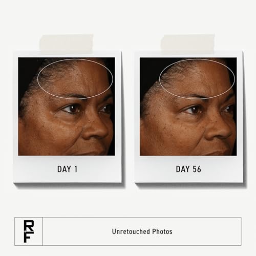 RODAN + FIELDS Redefine Daily Face Clay Cleanser (125 mL) | Advanced Skin Care | Exfoliating Face Wash & Face Mask for Sensitive Skin | Anti-Aging Face Cleanser for Women and Men