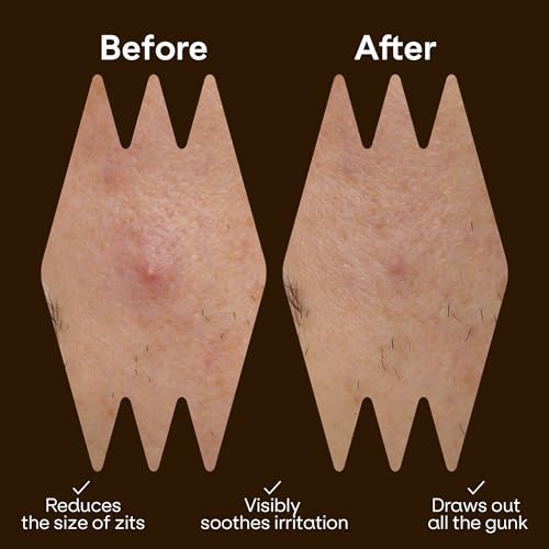 Cute Pimple Patches for Face - Tattoo Style Hydrocolloid Acne Patches (Confidence Patch) with Star Designs (66 Cute Patches) - Vegan & Cruelty-Free