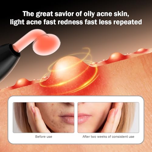 OxyGlow 2 Cordless High Frequency Facial Wand with 3 Tubes