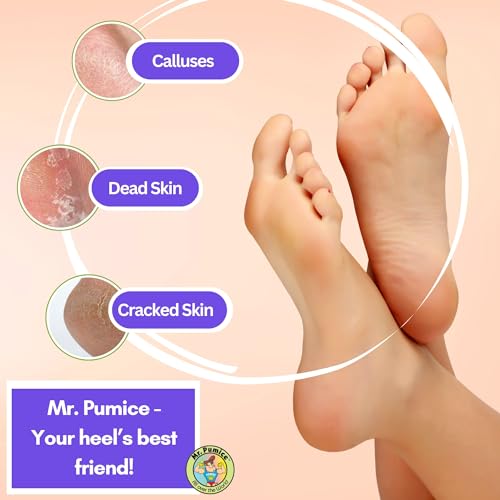 Mr. Pumice Ultimate Pumi Bar 2-in-1 Dual Grit Foot Callus Remover - 4 Pack