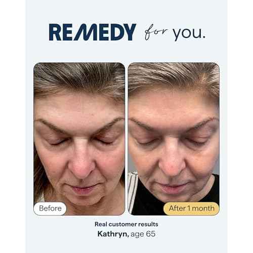 Remedy for Healthy Aging - Retinaldehyde, Resveratrol, Glycolic Acid, Argireline, Ferulic Acid, Matrixyl 3000 - Anti-Aging Treatment for Wrinkles, Uneven Texture & Tone - By Dermatologist Dr. Shah