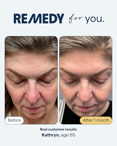 Remedy Science Anti-Aging Serum for Wrinkles & Uneven Skin Tone - Hydrating Night Treatment