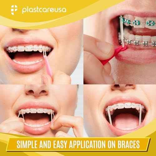 1000 (3/16" Rabbit, Heavy 6.5 Oz) Orthodontic Latex Elastic Rubber Bands for Braces - Multi-Size Dental Elastics Kit, Heavy-Duty Ortho Bands for Gap Closure & Teeth Alignment (10 Bags of 100)